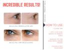 Distinction Firmalift Firming Face and Eye Serum with Elastisome | Ant