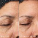 Medik8 C-Tetra Luxe Serum 30ml