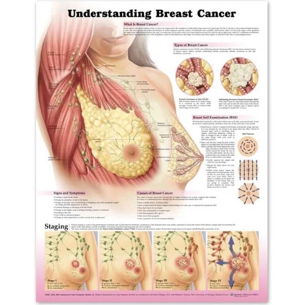 Understanding Breast Cancer 3e Paper